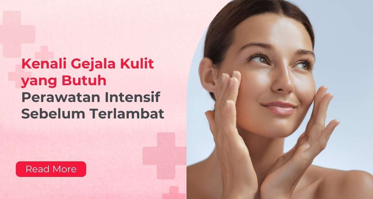 Kenali Berbagai Penyebab Jerawat Agar Kulit Tetap Sehat