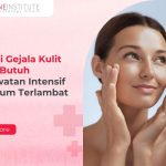 Kenali Berbagai Penyebab Jerawat Agar Kulit Tetap Sehat