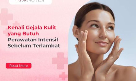 Kenali Berbagai Penyebab Jerawat Agar Kulit Tetap Sehat